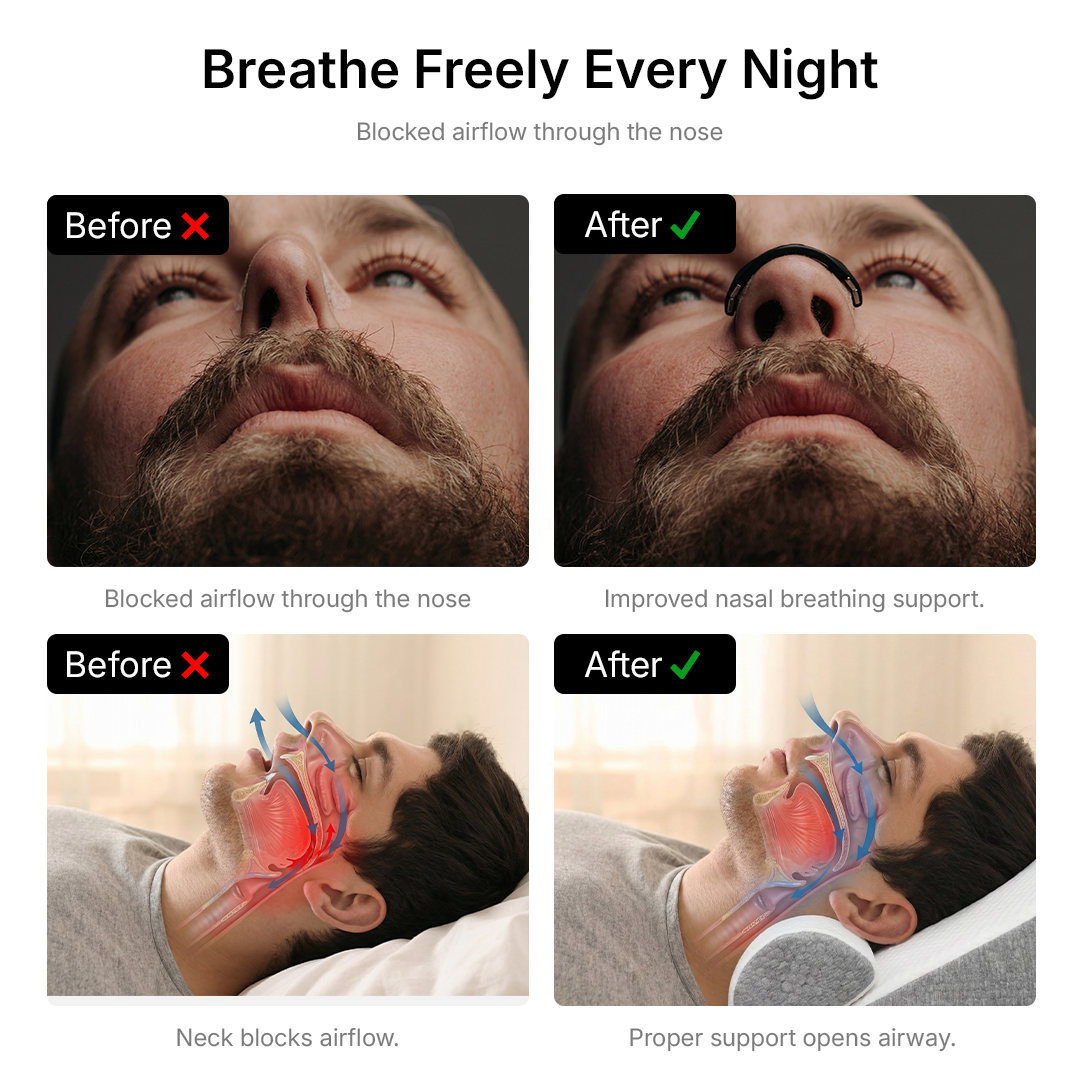 Snoring Solution Kit