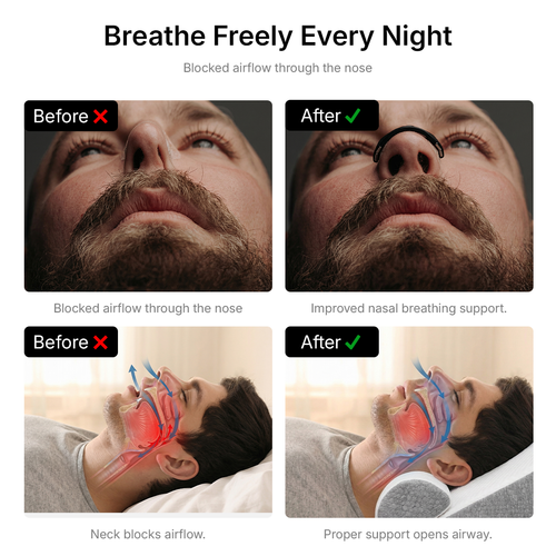 Snoring Solution Kit